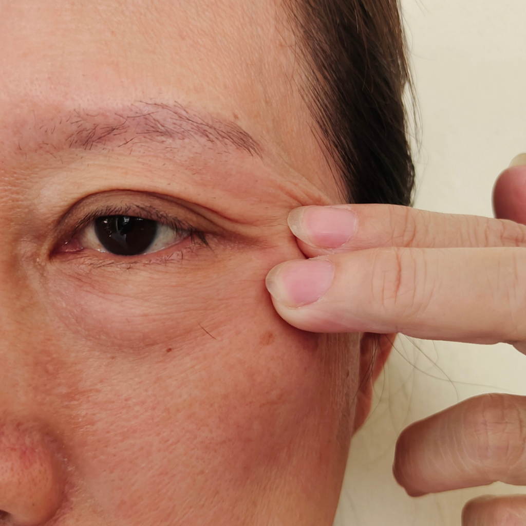 Eyelid Problems Treatment